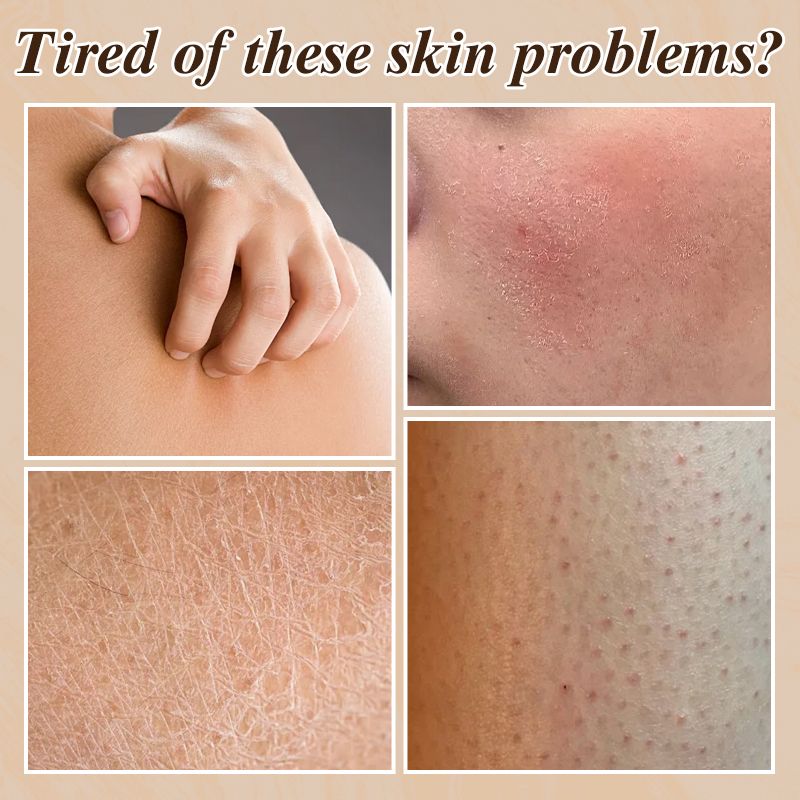 Hydraterende Voedende Spray Body Lotion