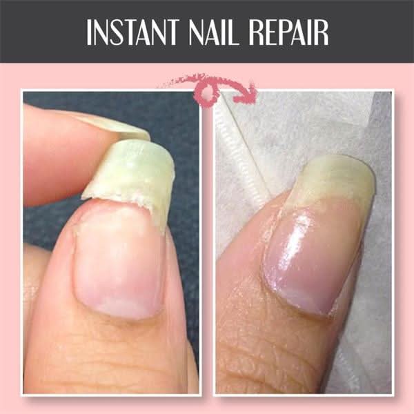 🔥Hoogtransparante 3-in-1 multifunctionele nagelherstelgel