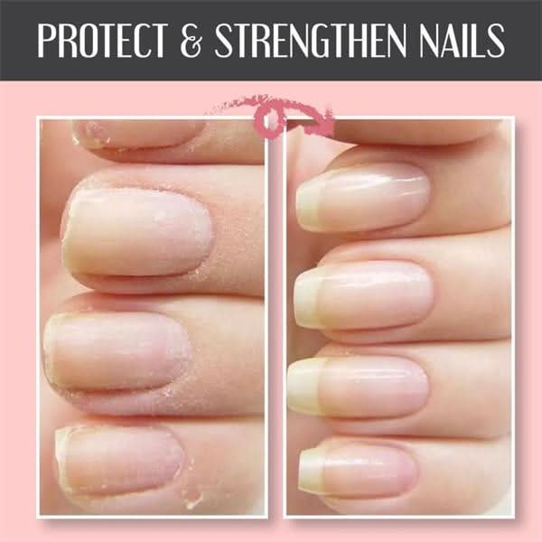 🔥Hoogtransparante 3-in-1 multifunctionele nagelherstelgel