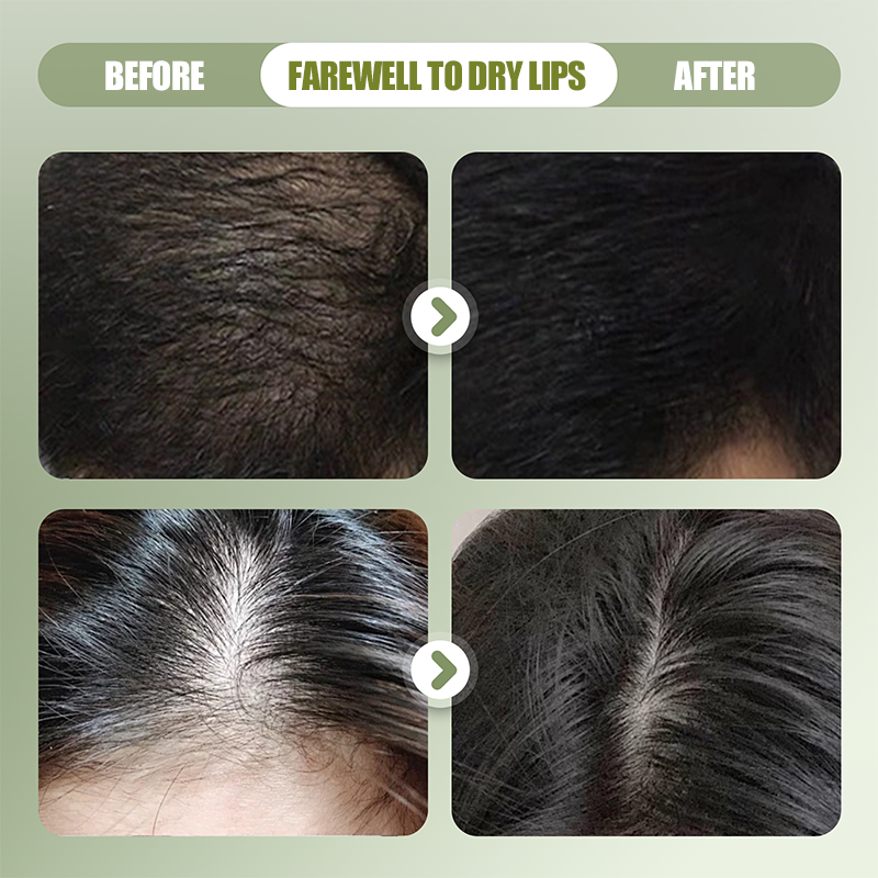 🔥Koop 1 krijg 1 gratis 🎁Natuurlijke shampoo bar voor sterker haar🌿