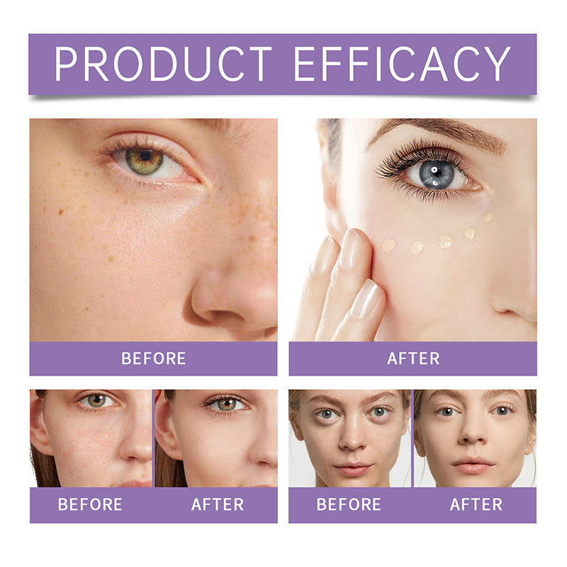 Perfect Cover Serum BB Cream - Bifida Ferment Lysate Serum-Doordrenkte BB Cream