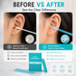 🔥Hot Sale 50% OFF🔥Double-Ended Ear Wax Removal Swabs
