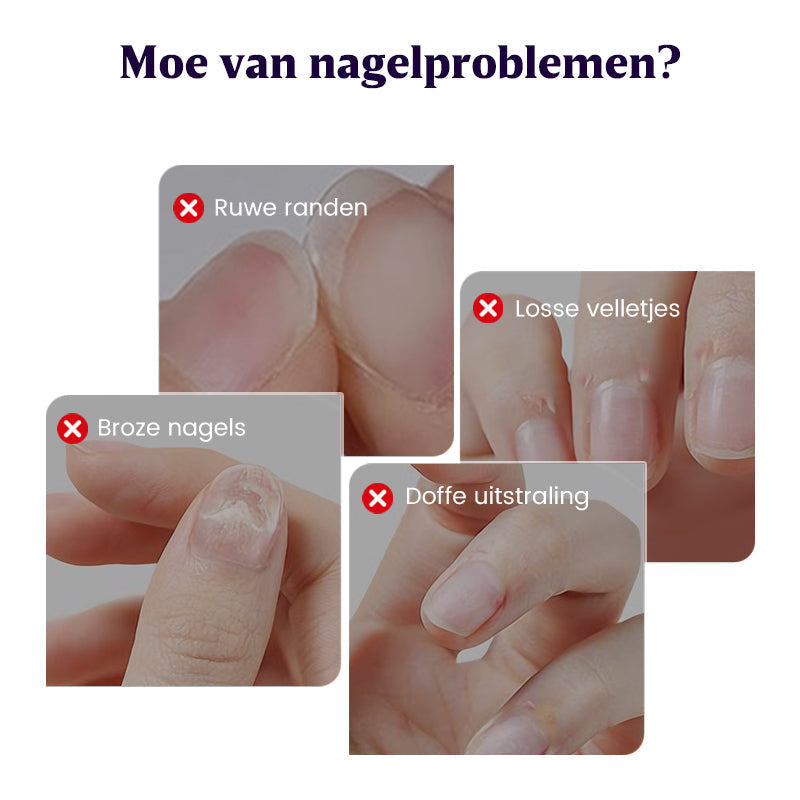 3-in-1 nagelverzorgingspen