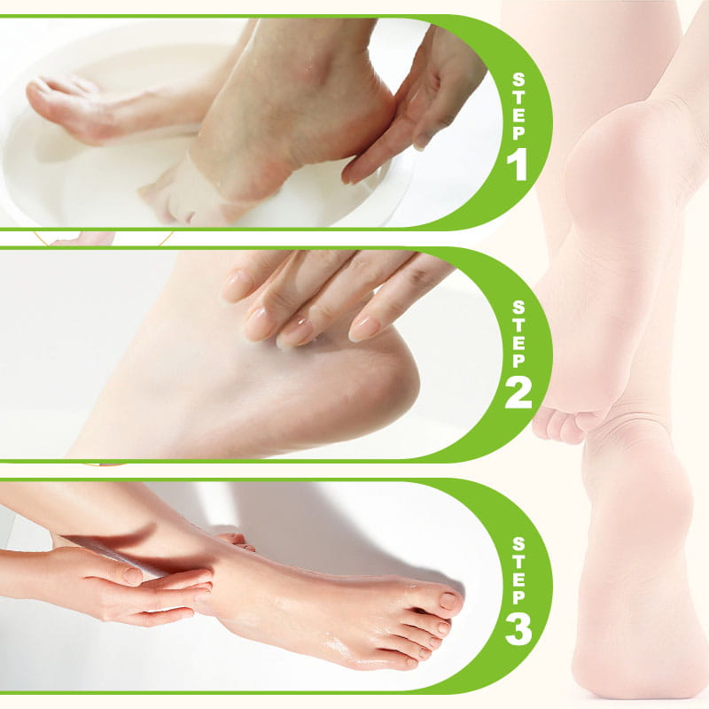 🌿🦶 Van ruwe, droge voeten naar zachte, gladde huid – deze crème met ureum en aloë vera verwijdert eelt en kloven, met een heerlijk frisse geur. 50% KORTING!