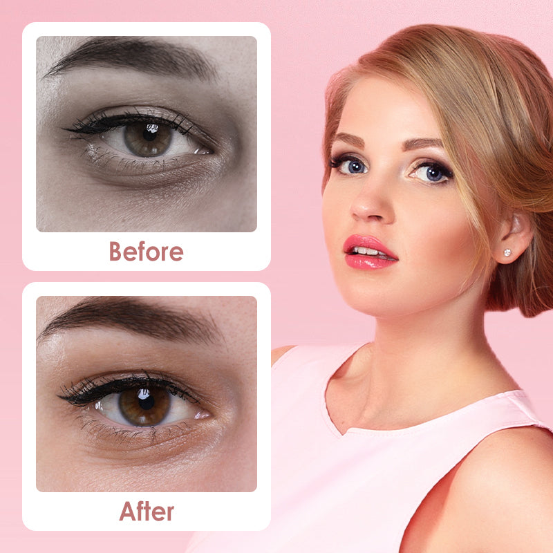 🔥 Laatste dag SALE 50% KORTING🔥 Under Eye Brightener – voor een stralende blik zonder wallen!