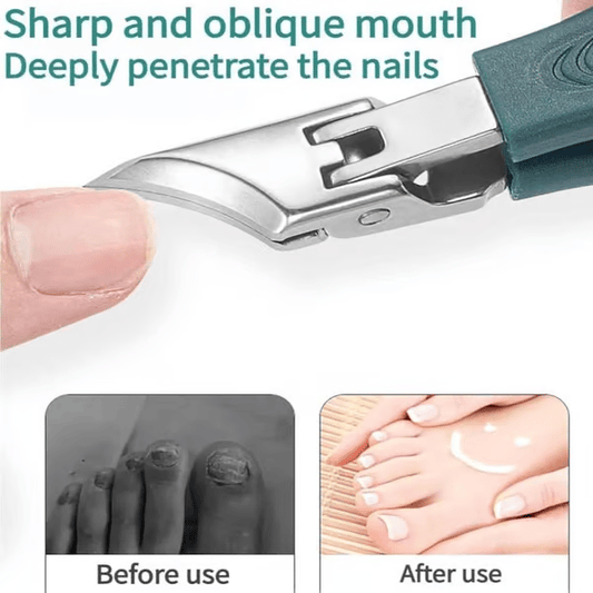 🔥Door pediaters aanbevolen nagelknipper - Ergonomisch schuin ontwerp voor teennagels en ingegroeide nagels - Beperkte aanbieding van 49