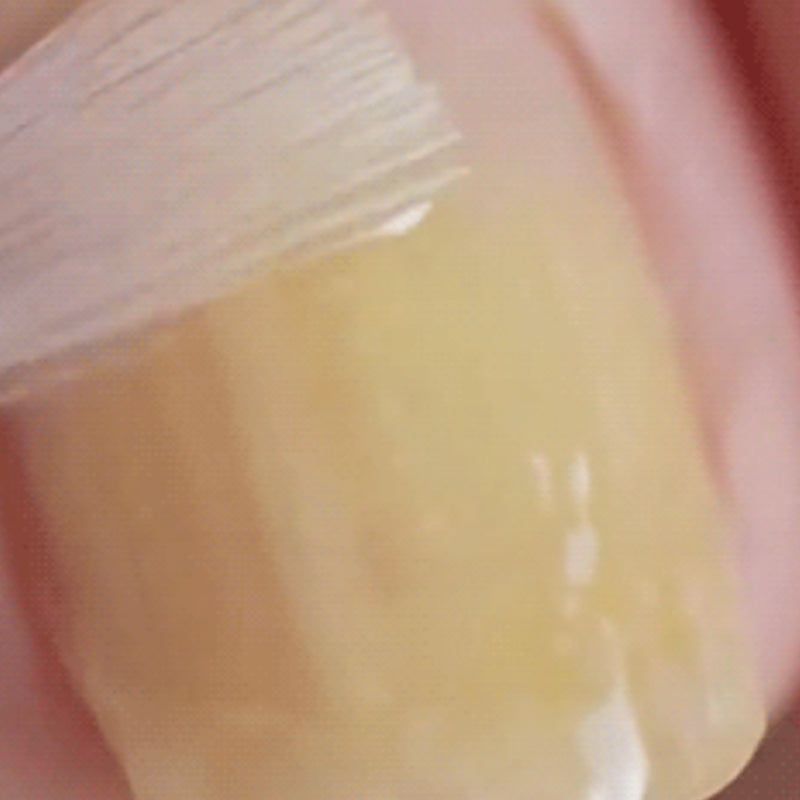 Zachte en effectieve natuurlijke oplossing voor nagelherstel