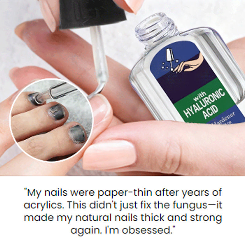 Zachte en effectieve natuurlijke oplossing voor nagelherstel