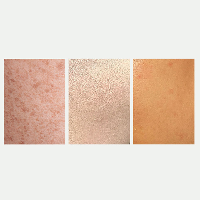 Verhelderende en vlekverminderende gezichtsspray