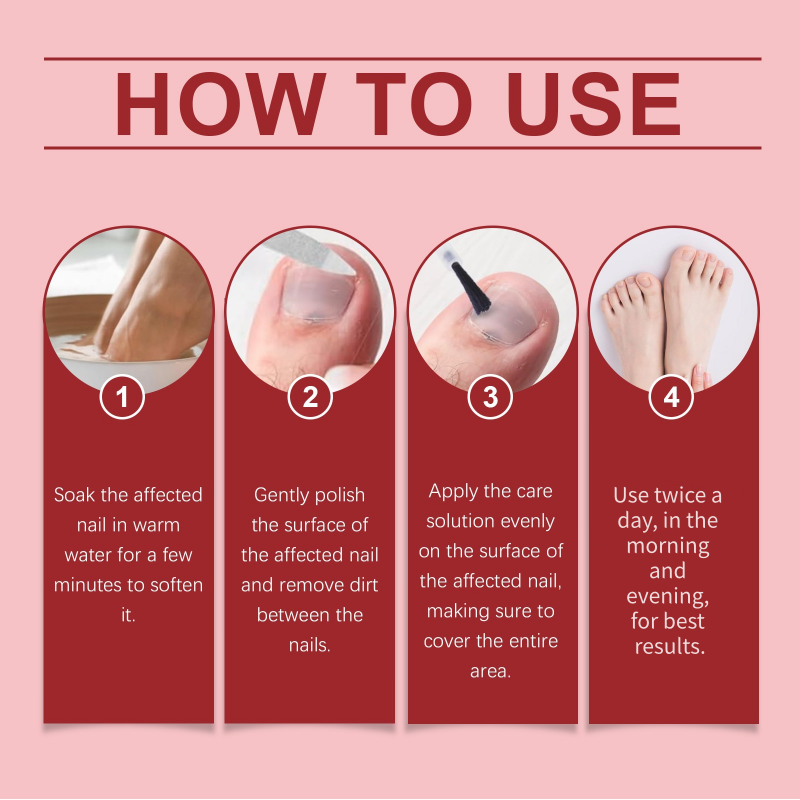 🔥Populaire aanbieding – 50% KORTING!🔥🖤Zie sneller echte resultaten🖤 2 flesjes Nagelreparatie Essence voor beschadigde nagels💅🏽