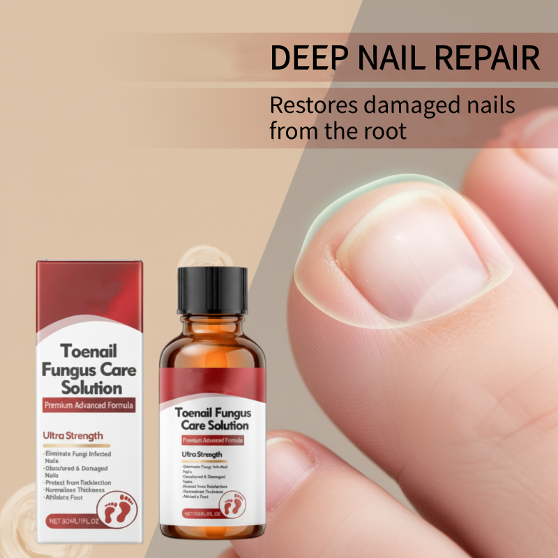 🔥Populaire aanbieding – 50% KORTING!🔥🖤Zie sneller echte resultaten🖤 2 flesjes Nagelreparatie Essence voor beschadigde nagels💅🏽