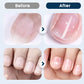 💅 Voedende Nagelherstel Spray – Voor Sterkere & Gezondere Nagels ✨