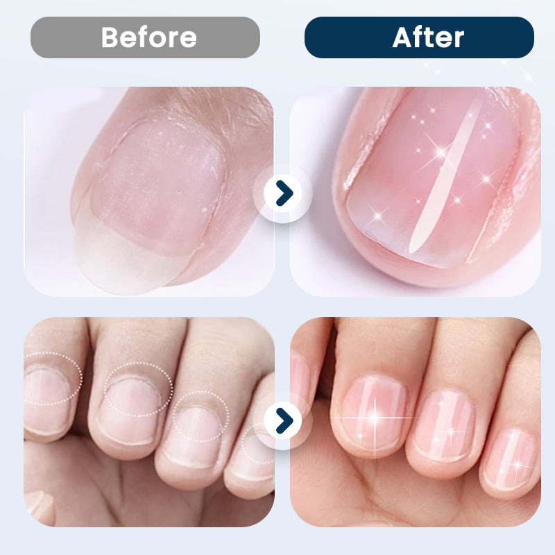 💅 Voedende Nagelherstel Spray – Voor Sterkere & Gezondere Nagels ✨