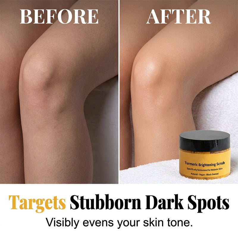 ✨🧡 50% KORTING! Kurkuma Bodyscrub – Zijdezachte Huid & Een Stralende Glow 🌿
