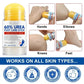 🎉42K+ Sold 🦶 Urea Foot Care Stick, Intensive Moisturizing Balm for Dry Cracked Heels & Dead Skin