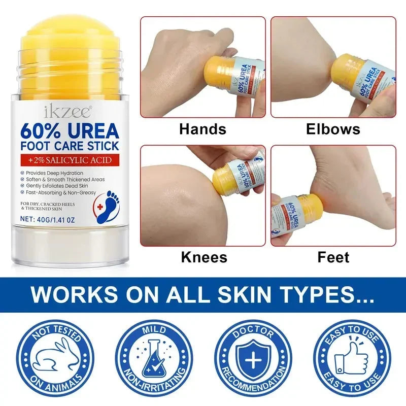 🎉42K+ Sold 🦶 Urea Foot Care Stick, Intensive Moisturizing Balm for Dry Cracked Heels & Dead Skin