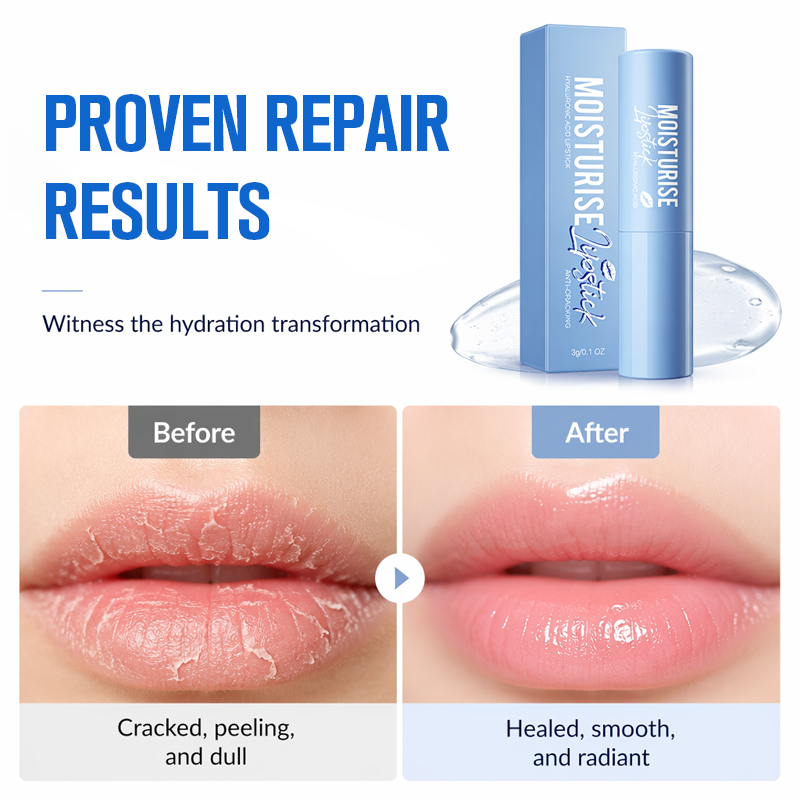 💋 Baume à lèvres à l'acide hyaluronique – hydrate, repulpe et répare les lèvres sèches instantanément.