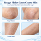 ✨ 50% korting! SVAYSHIIN body scrub gel – verwijdert ruwe, schilferige plekken, milde transparante gel & nauwkeurige gouden spuitmond. 15 ml – voor ellebogen, knieën & armen! 💧🧴